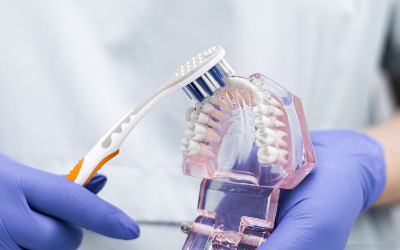 How to Clean Dentures: Daily Care and Warning Signs