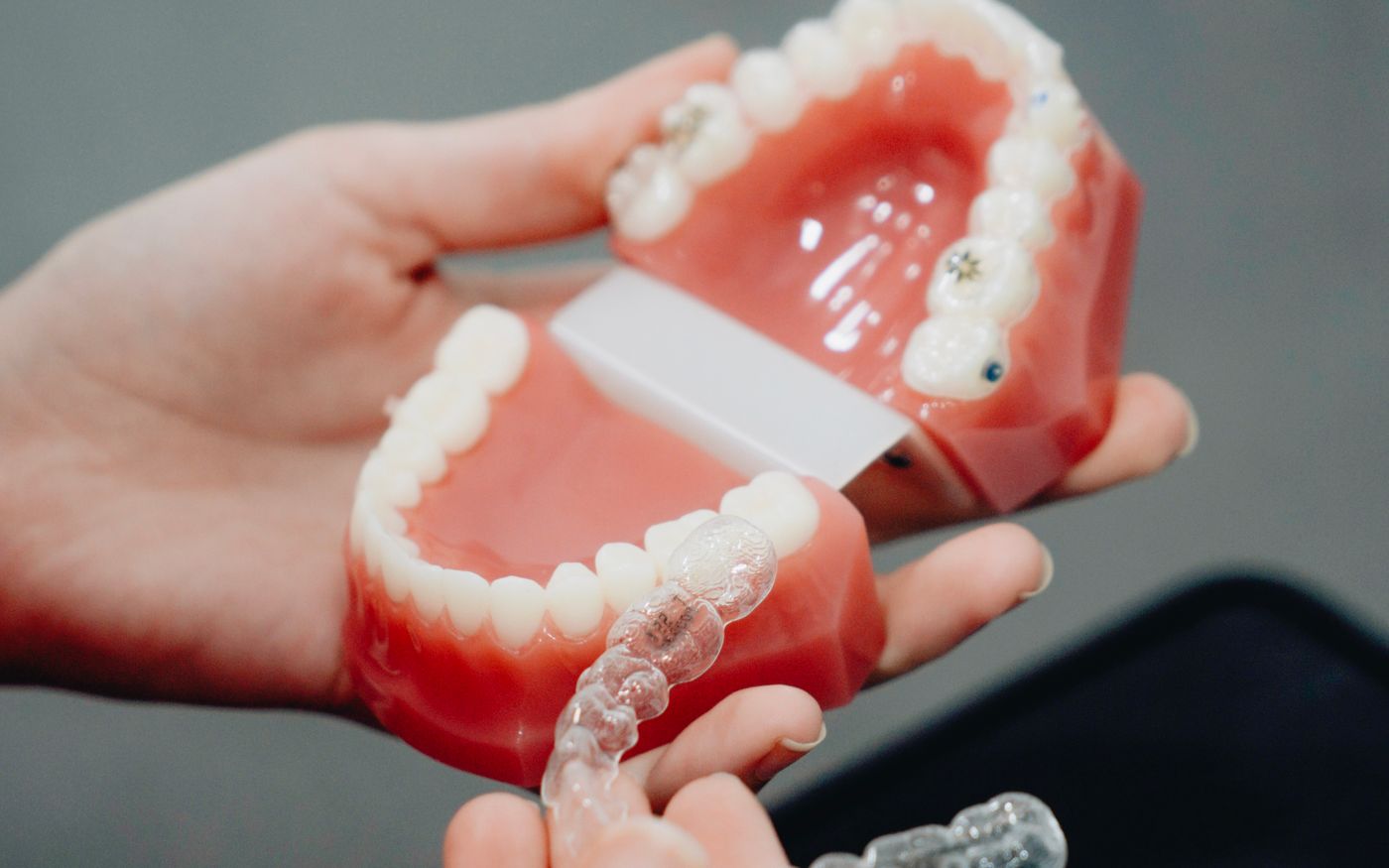 How to Clean a Retainer After Braces
