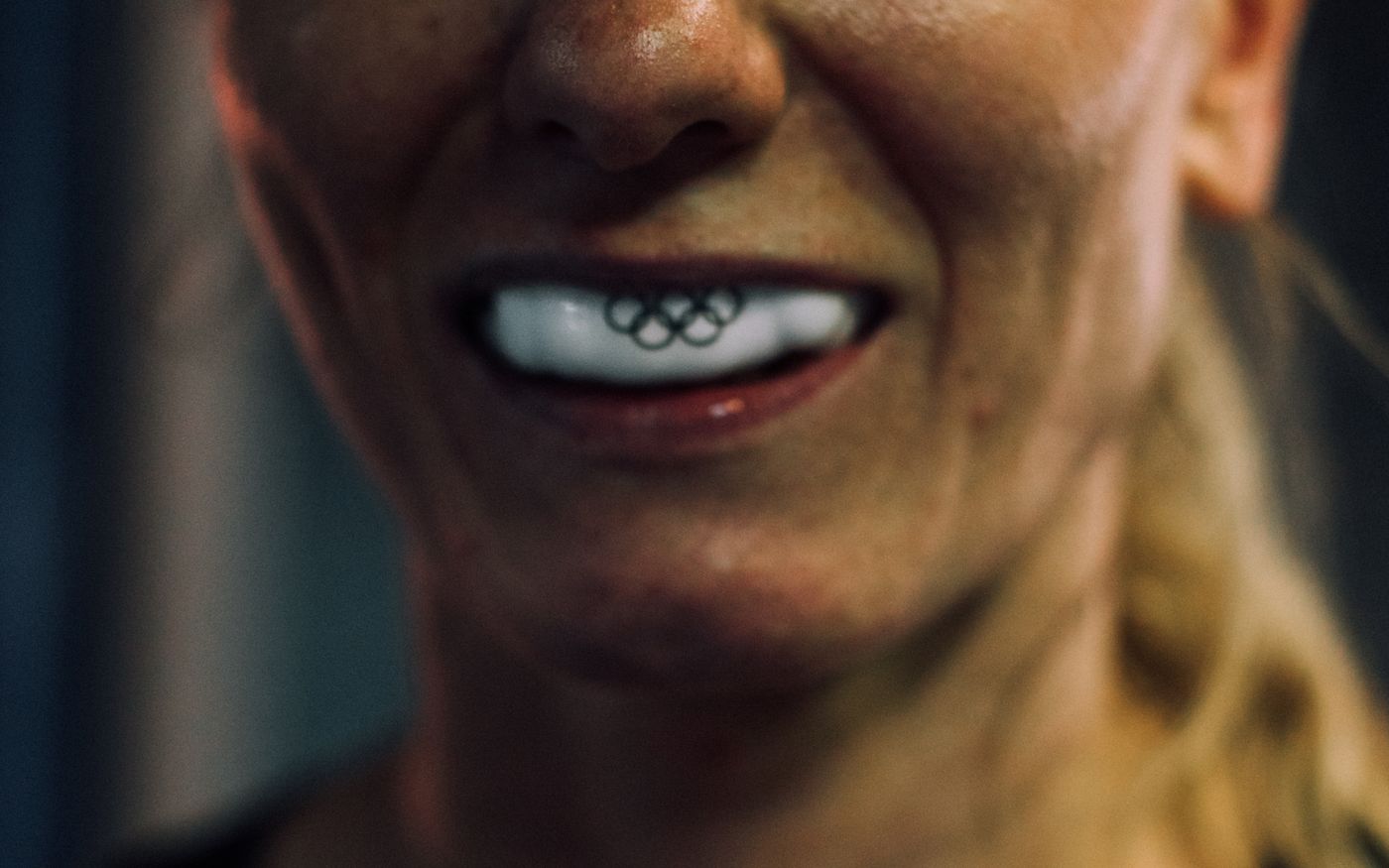 Sports Mouthguards in Konstanz: Protecting Teeth During Activity