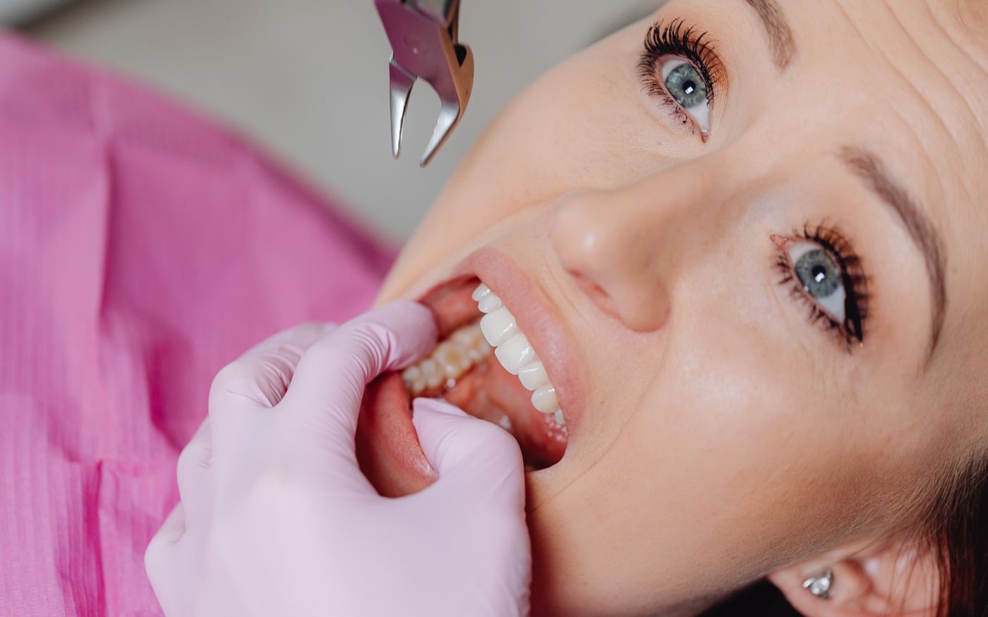 Tooth Extraction Aftercare in Konstanz: What Matters Next